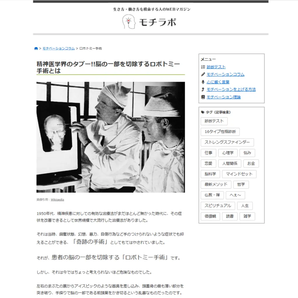 No.037 精神医学界のタブー!!脳を切除するロボトミー手術 website